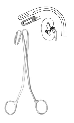 Kidney Stone Forceps